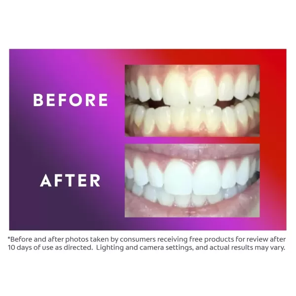 imageColgate Optic White ComfortFit Teeth Whitening Kit with LED Light and Whitening Pen LED Teeth Whitening Kit Enamel Safe Works with iPhone and AndroidLED Kit  Pen